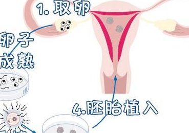 孕妇产后是花钱去专业的月子中心好还是在家坐月子好？