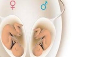 我想知道，男性无精症可以做试管吗？